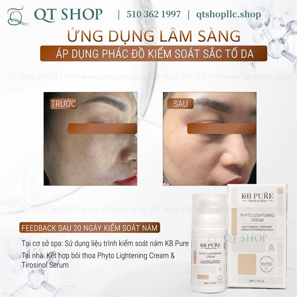 02e2f046eefd4e27aba97da8544b7fcd KB Pure - Phyto Cream - Kem Trị Nám Trắng Da - 107$