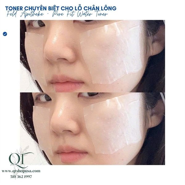 Toner Feld Apotheke Pore-Fit Water – Giải Pháp Se Khít Lỗ Chân Lông Bền Vững - 265ml EXP 2028.09.28