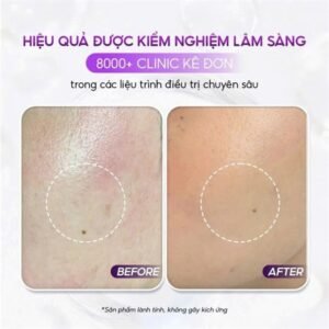 Pharmesthetics - Conapidil Lotion Polishing 200ml - Dầu tẩy trang
