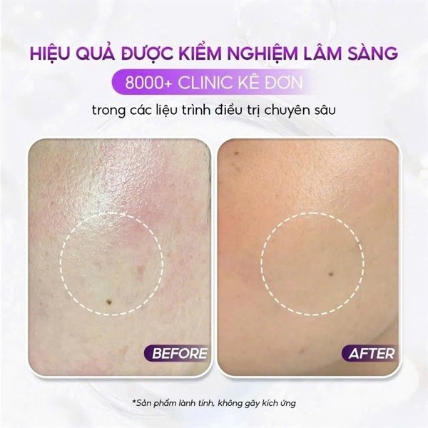 Pharmesthetics - Conapidil Lotion Polishing 200ml - Dầu tẩy trang