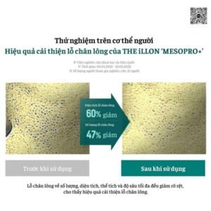 2685c79232374e9aad121c4cfad0d033 THE iLLON - MESOPRO + KIT - 2ea + 2 masks