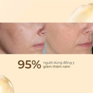 SDM - AZELAC RU Liposomal Serum - EXP 202708