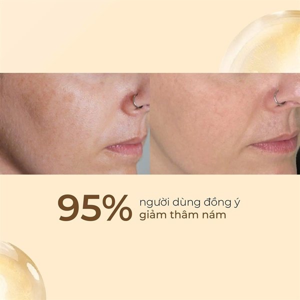 SDM - AZELAC RU Liposomal Serum - EXP 202708