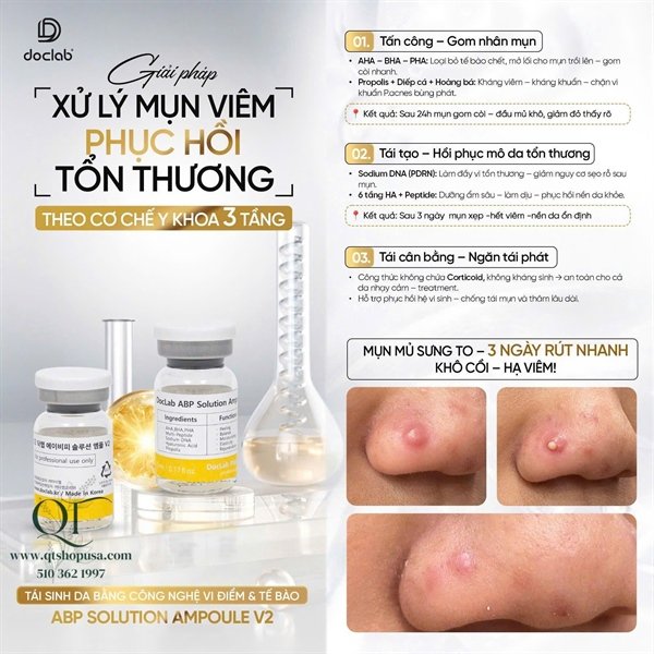 DOCLAB - ABP Solution Ampoule V2: TBG đặc trị mụn - 5ea - EXP 202707