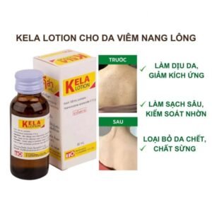 Kela Lotion trị viêm lỗ chân lông LCL Thai Lan - 60ml - EXP 20280522