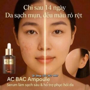 83f5d4f4c79b4324b1c082a0bd574748 Serum trị mụn AC BAC