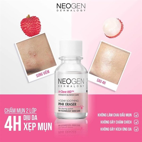 Chấm Mụn Neogen - exp 20280415