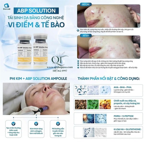 DOCLAB - ABP Solution Ampoule V2: TBG đặc trị mụn - 5ea - EXP 202707