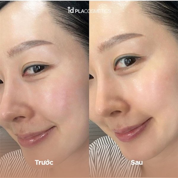 d1187036ef21494599a21f15728853db ID_Placosmetics Face Fit Patch V3 - 4ea