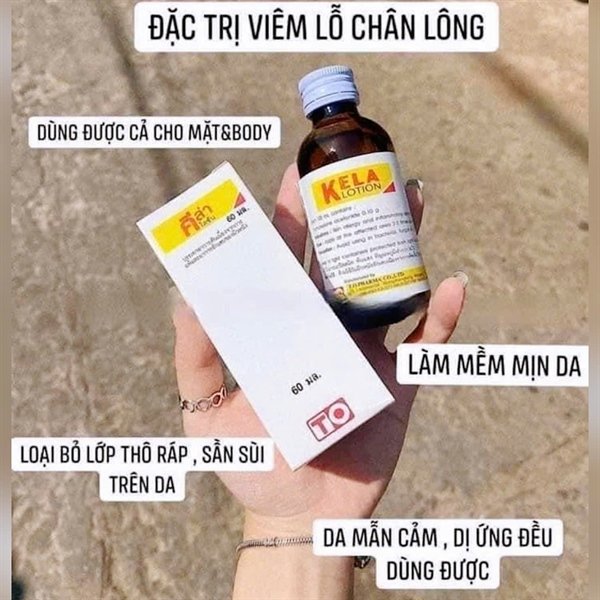 Kela Lotion trị viêm lỗ chân lông LCL Thai Lan - 60ml - EXP 20280522