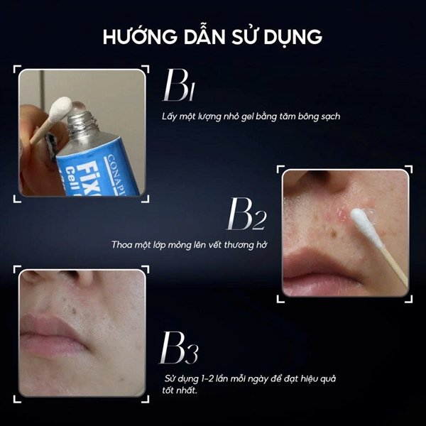 Pharmesthetics - Conapidil Fixcica 13grams - Chấm Mụn